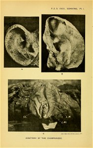 n395_w1150