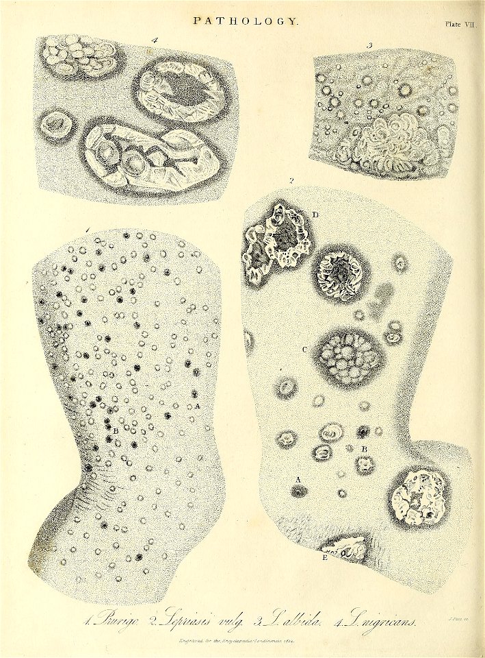 n377_w1150