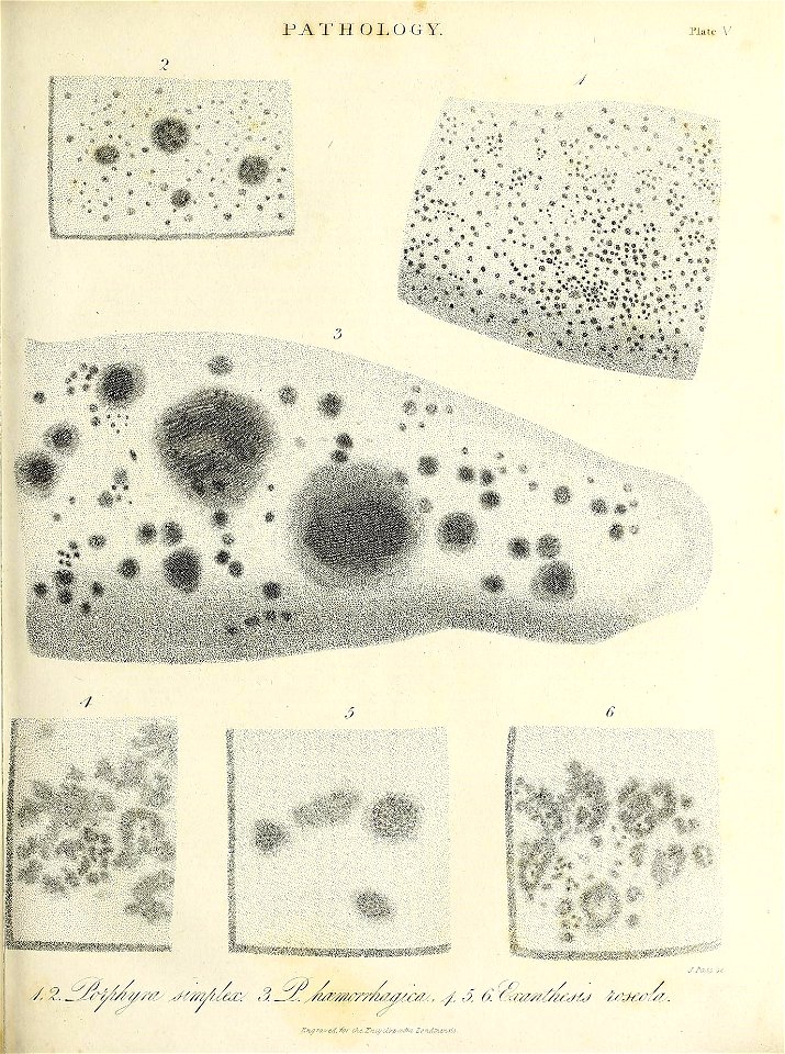 n314_w1150