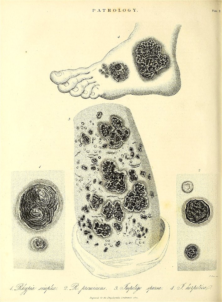 n387_w1150