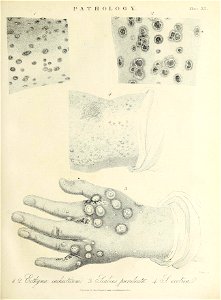 n396_w1150