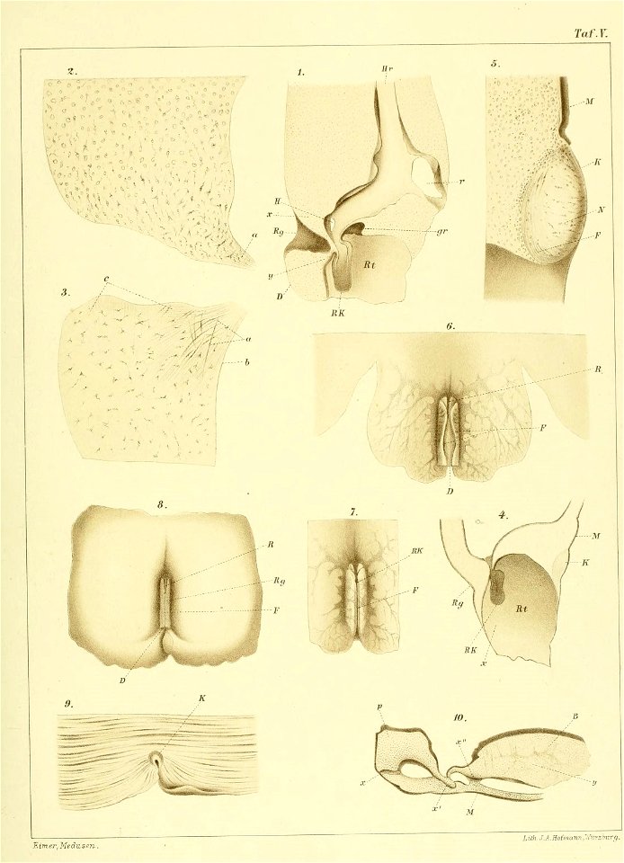 n318_w1150