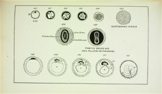 n177_w1150