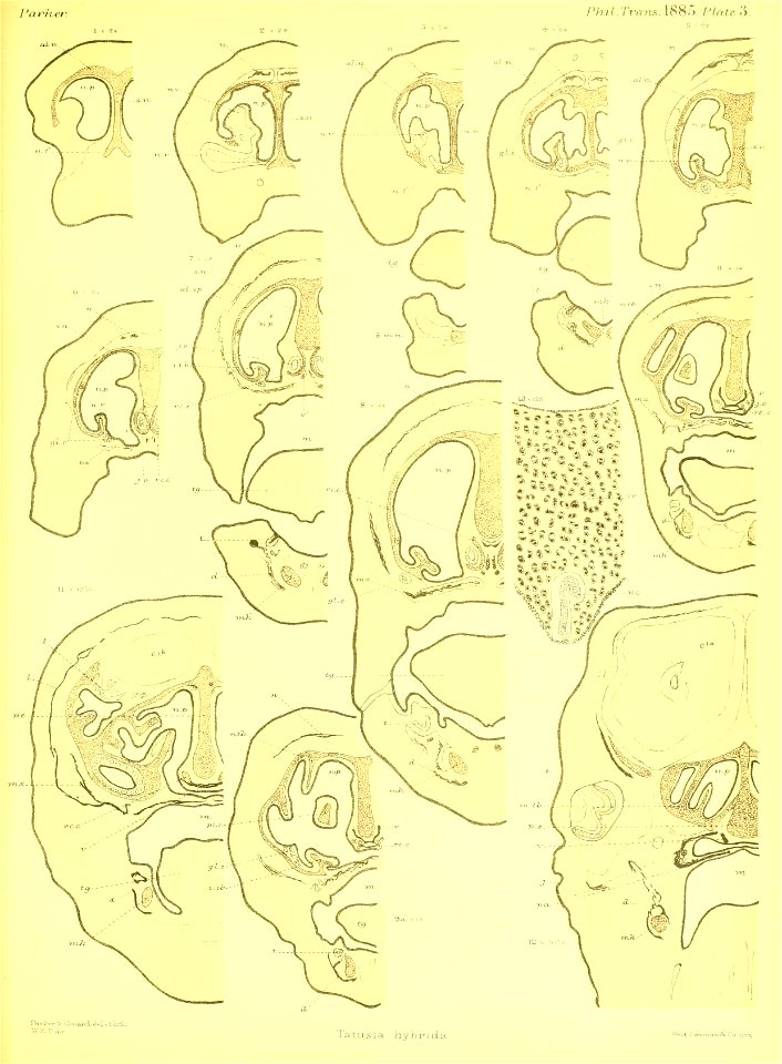 n376_w1150