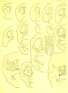 n376_w1150