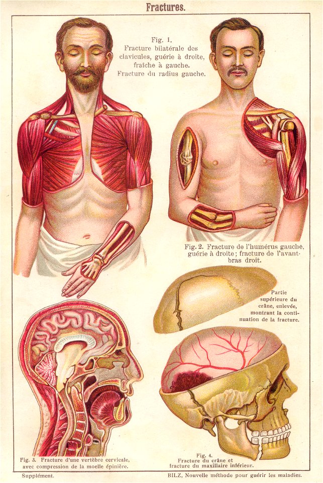 anatomie fractures 1