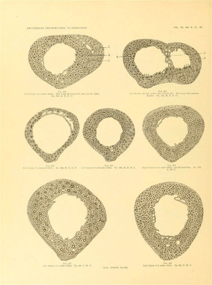 n681_w1150