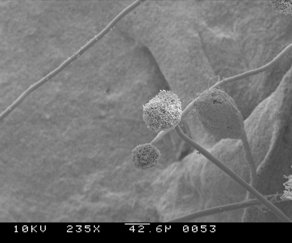 235 magnifications fungus