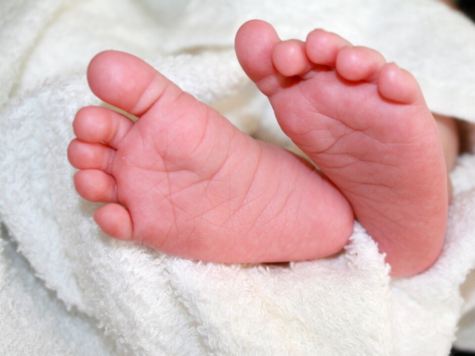 Newborn infant skin