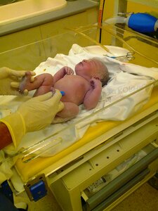Delivery room navel care