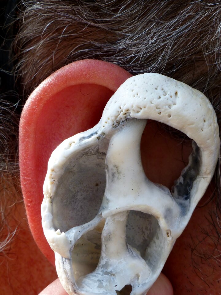 Inner ear balance archway