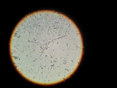 Bacteria microscope microscopic image photo
