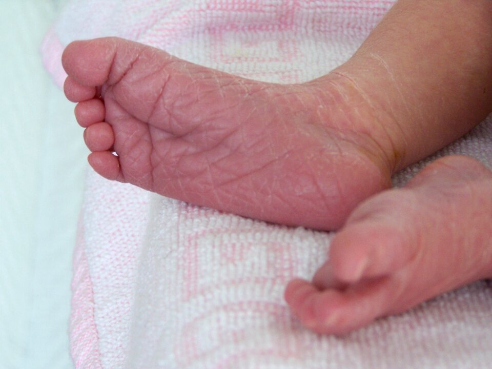 Birth child dry skin