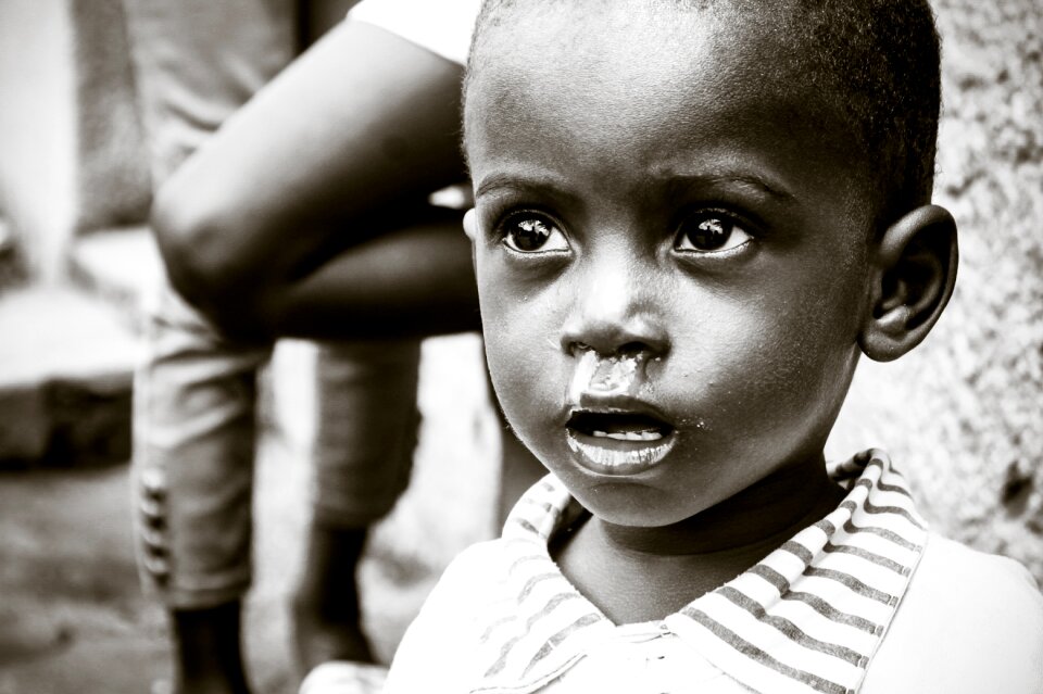 Ebola abuse malnutrition