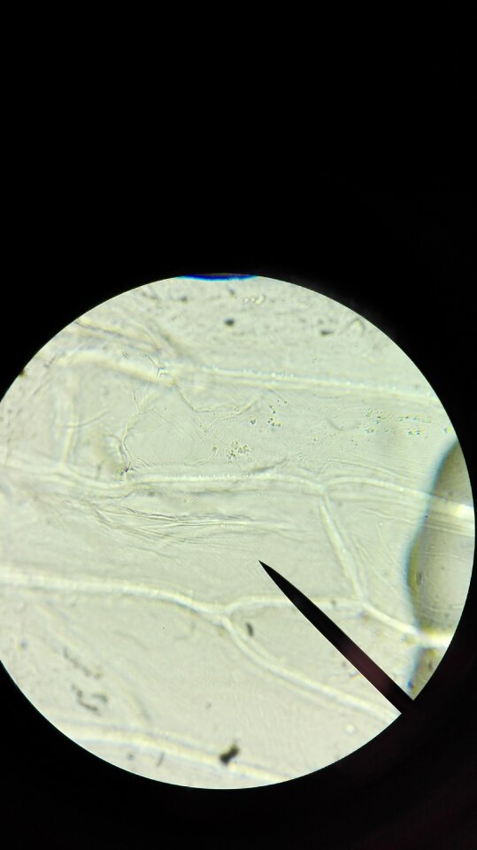 Explore magnification needle