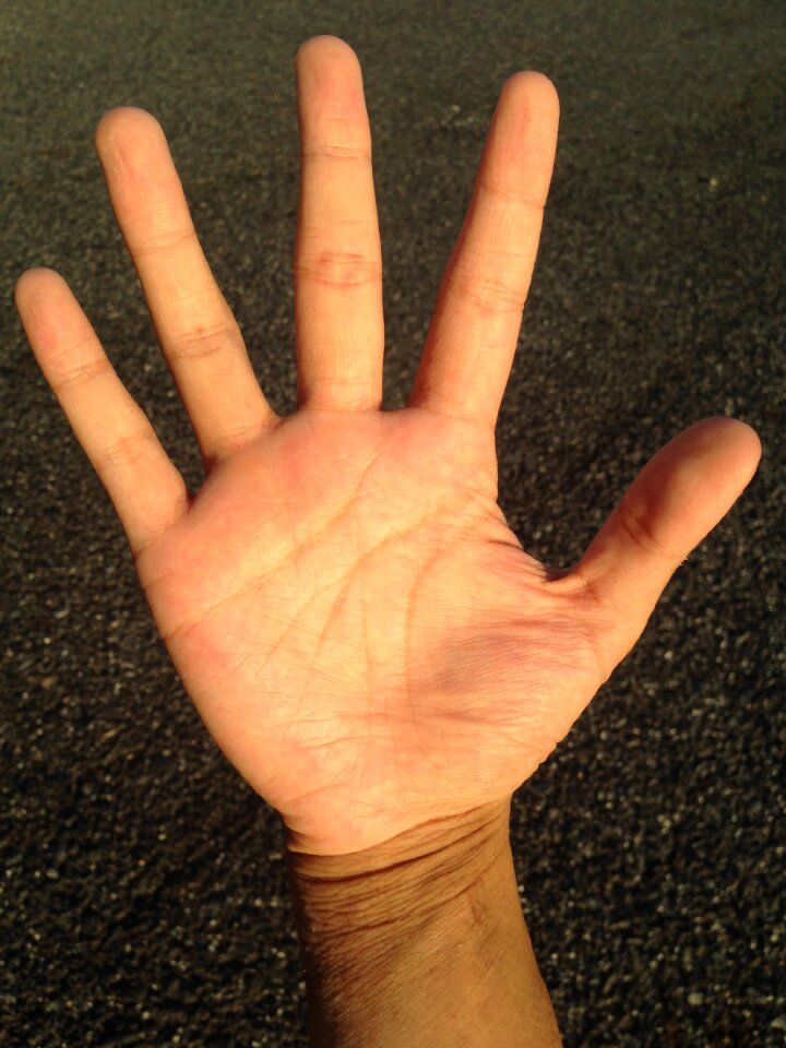 Bleaching palm reading young