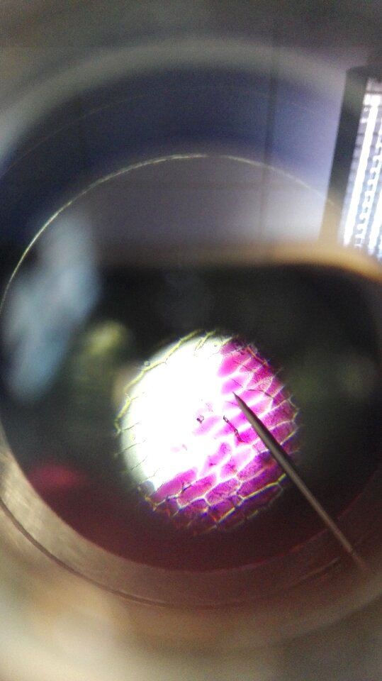 Explore magnification needle