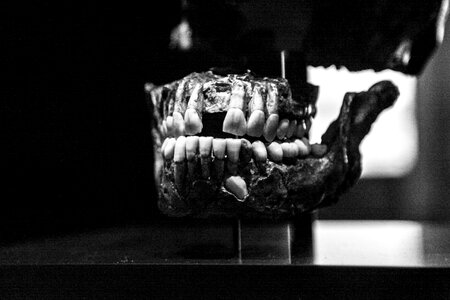 Old black and white dental