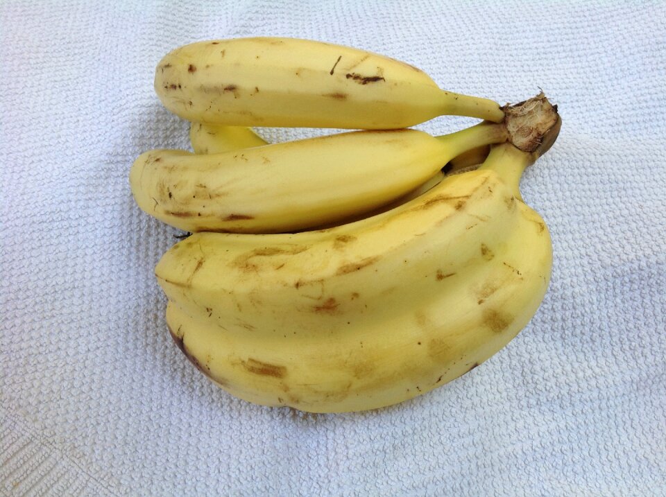 Twin banana double banana siamese twin