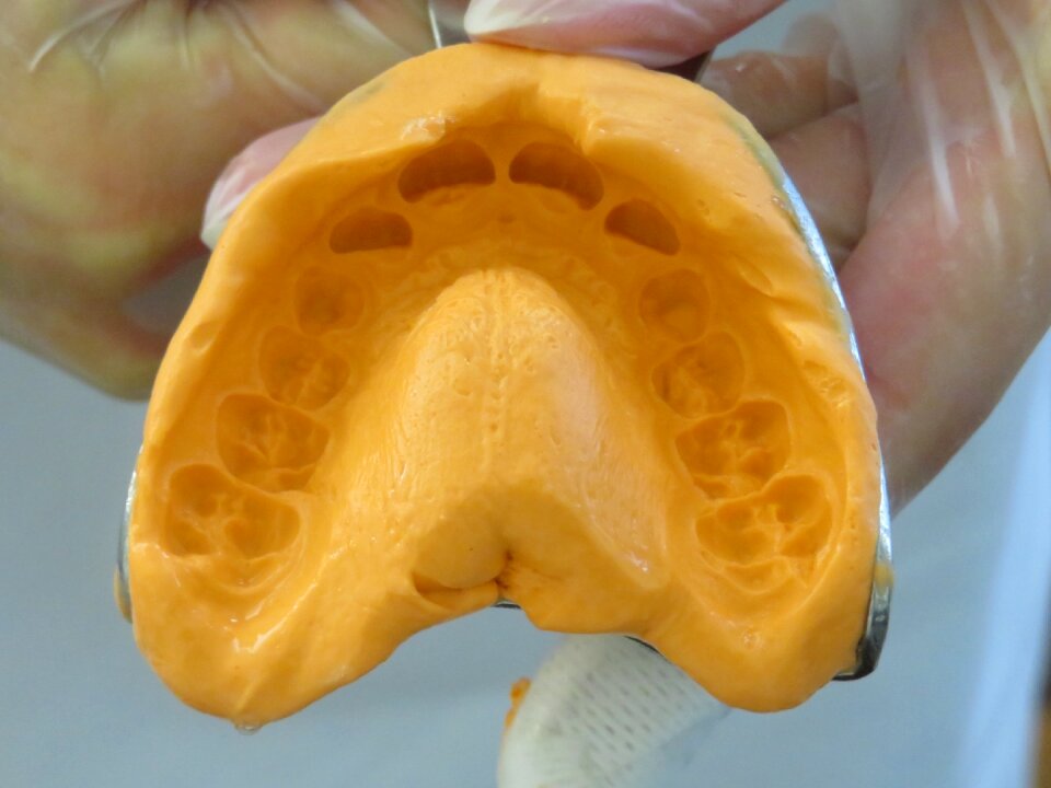 Dental braces tooth mouth