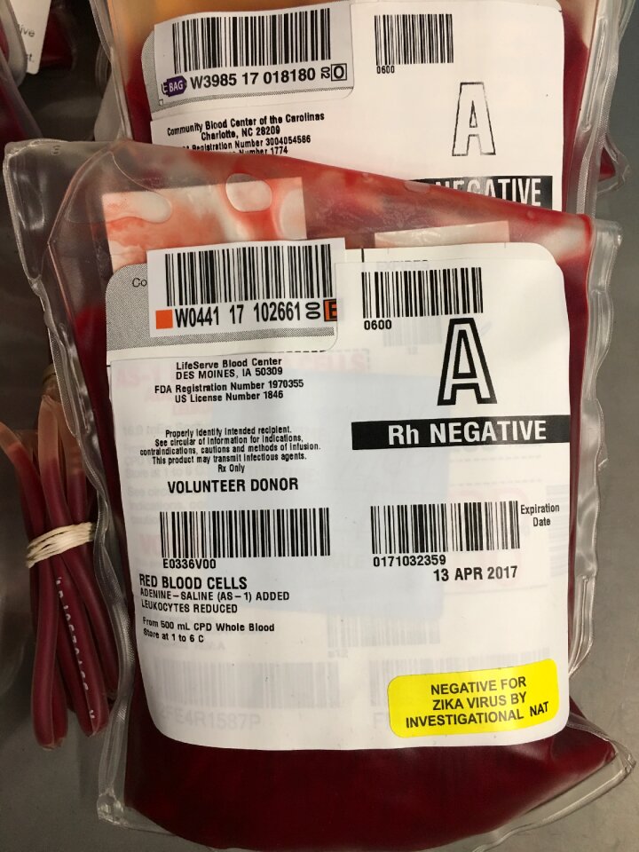 Transfusion brown blood