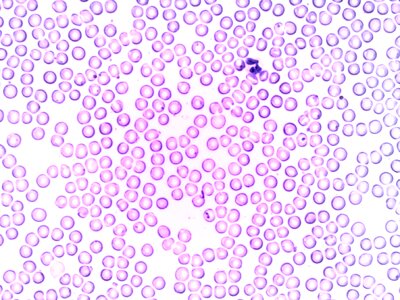 Granulocyte blood cell laboratory photo