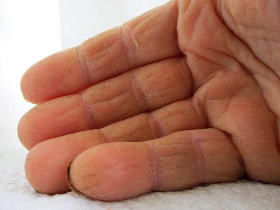 People fingers skin