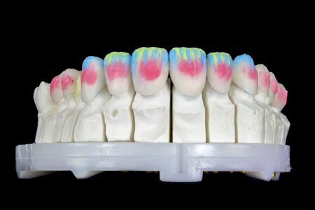 Lenses dental ceramica porcelain