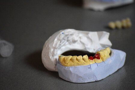White mouth health