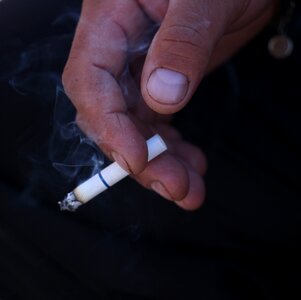 Smoking hand disease
