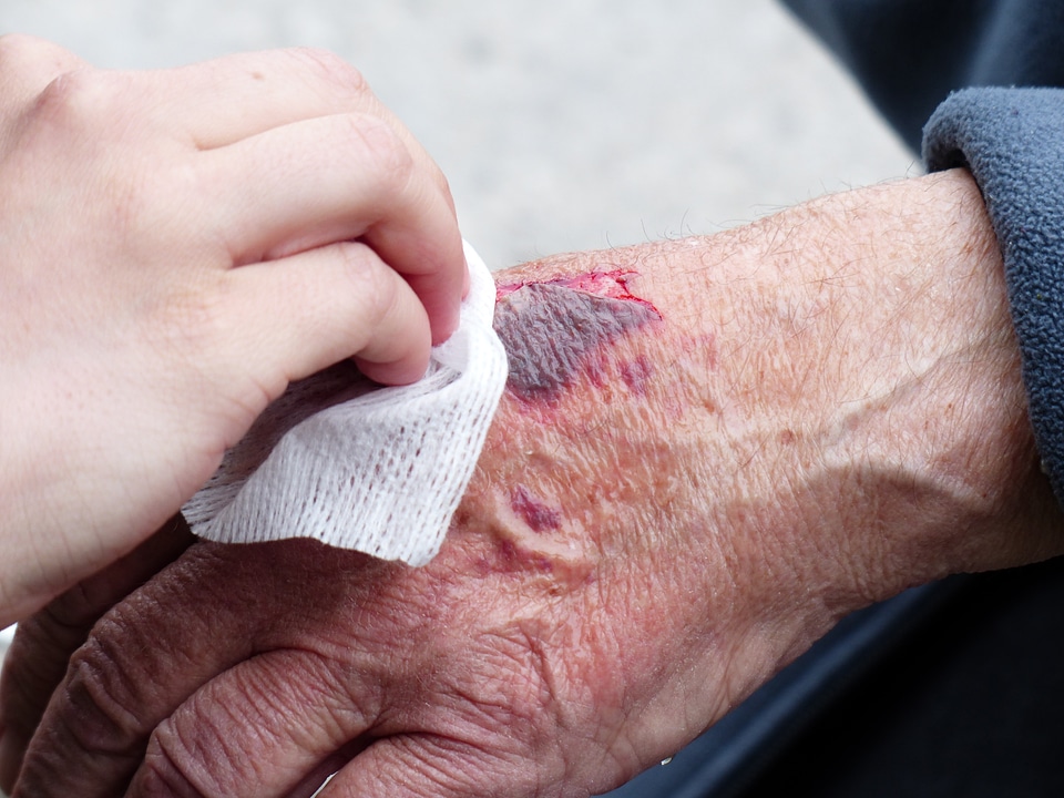 Blood crack disinfection