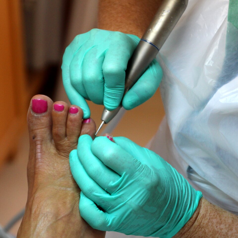 Foot toes eksteroog