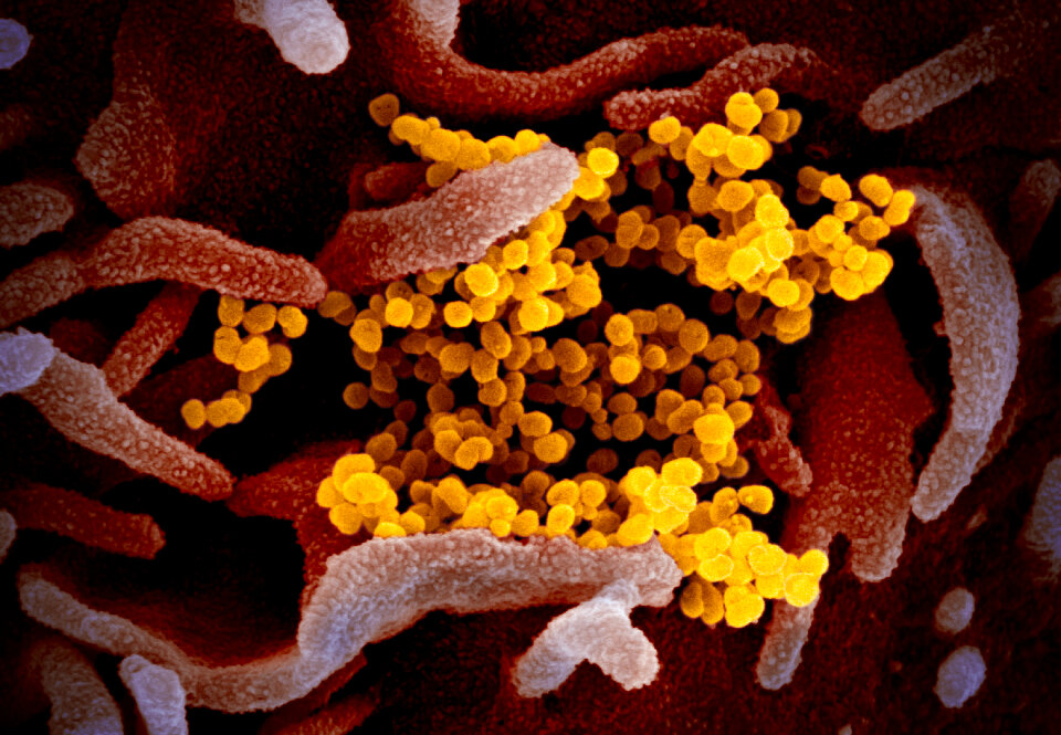 COVID-19 virus Coronavirus disease
