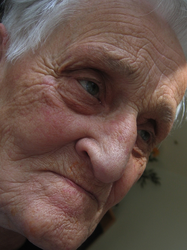 Dependent age alzheimer's