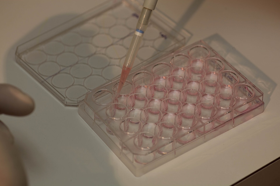 Analysis biology labor