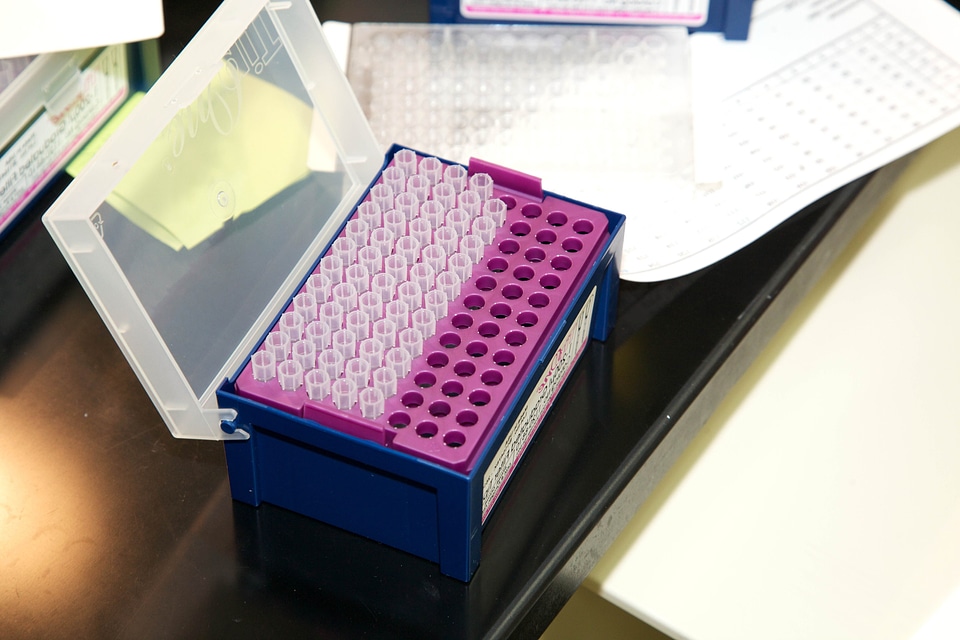 Acid analysis blood