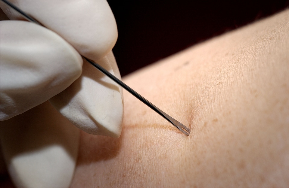 Bifurcated Needle close close-up