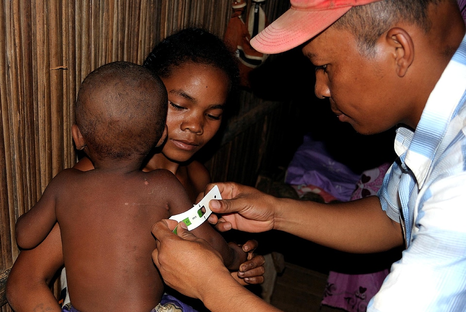 Check circumference malnutrition