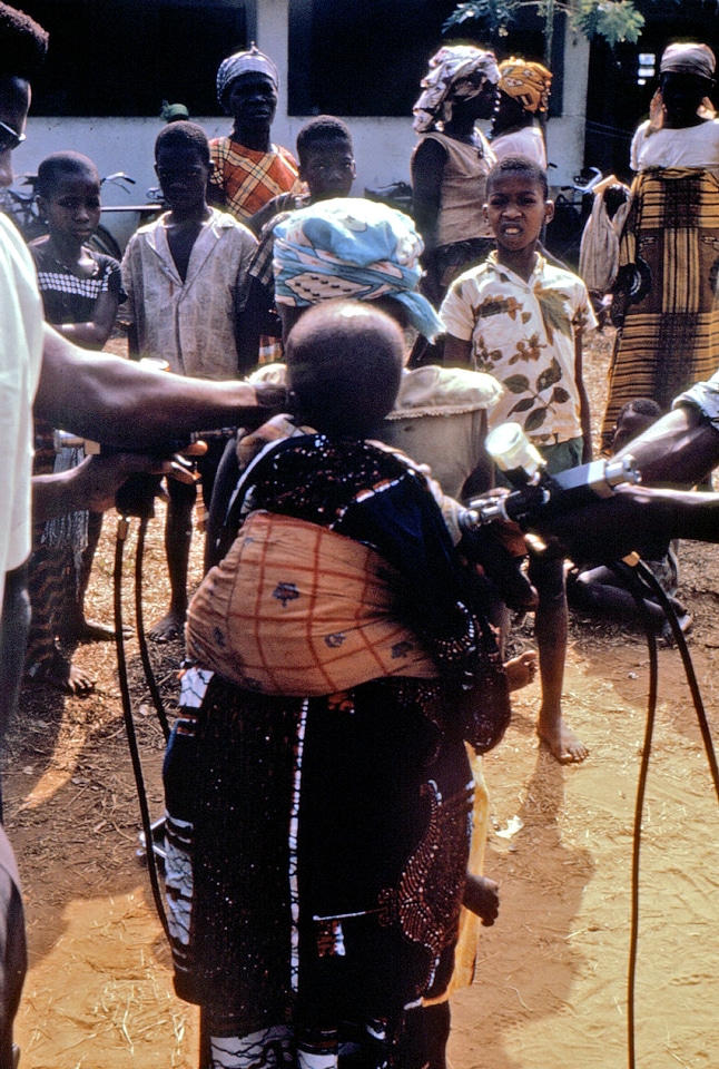 Babies smallpox 