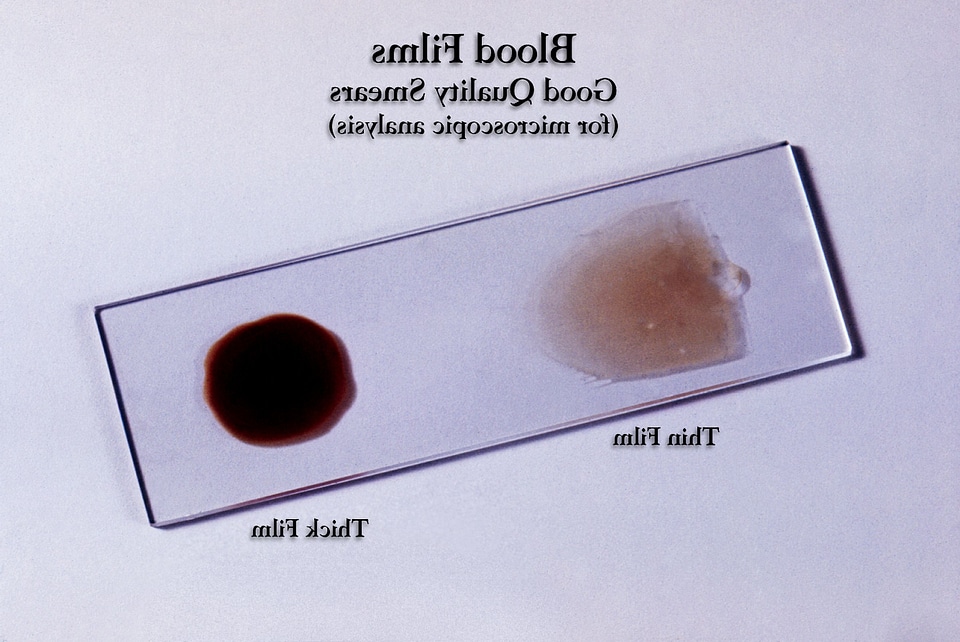 Blood cervical smear estate