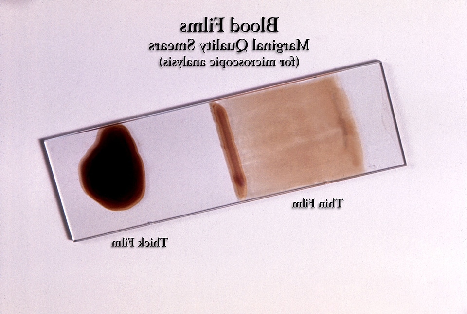 Appearance blood example