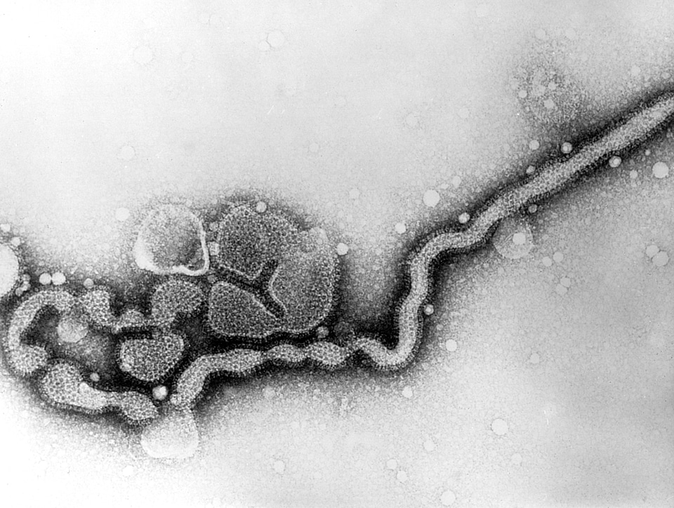 Broadcast electron electron micrograph