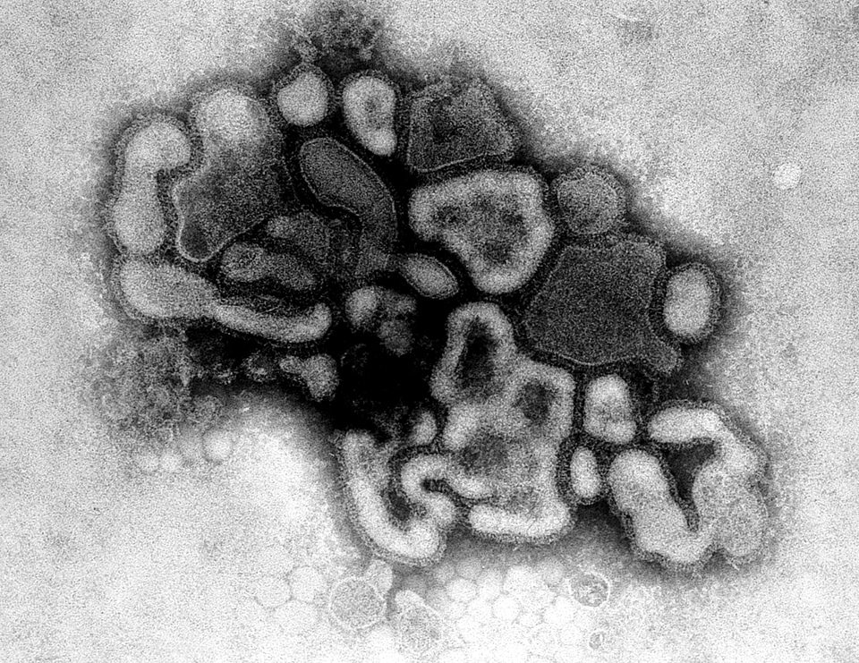 Electron electron micrograph jersey