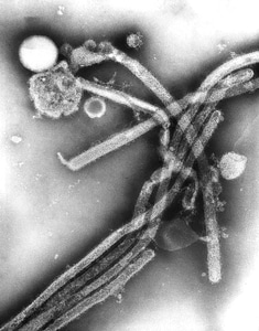 Influenza number presence