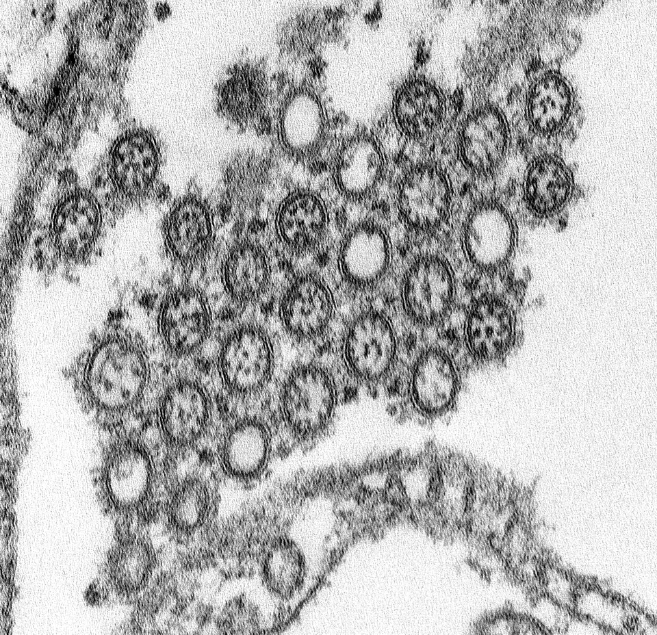 Electron electron micrograph novel