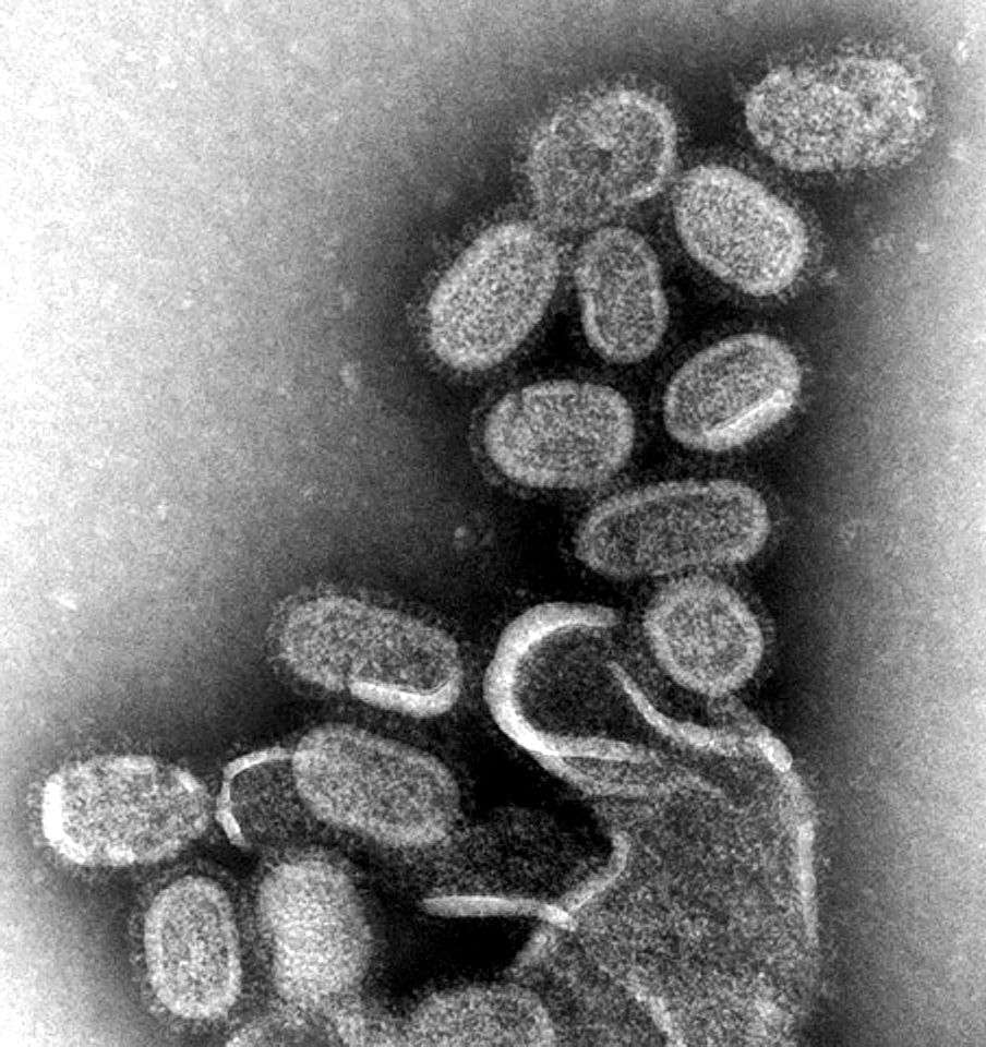 Canine influenza kidney
