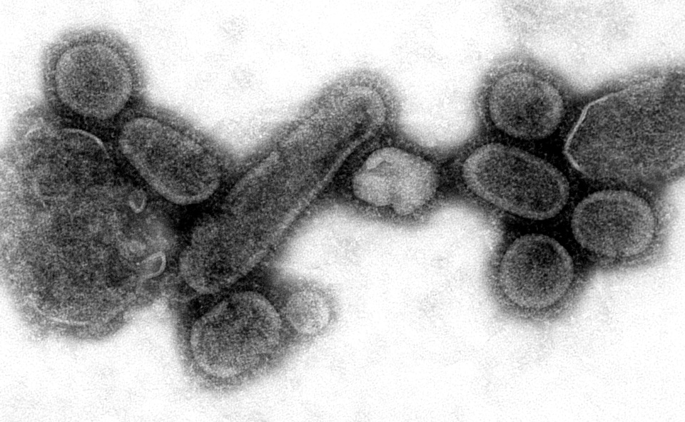 Electron electron micrograph influenza