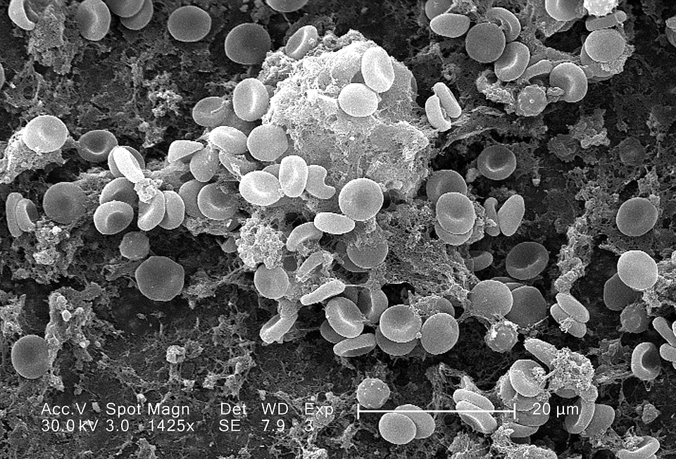 Catheter matrix surface photo