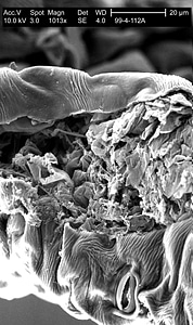 Leaf lesion location