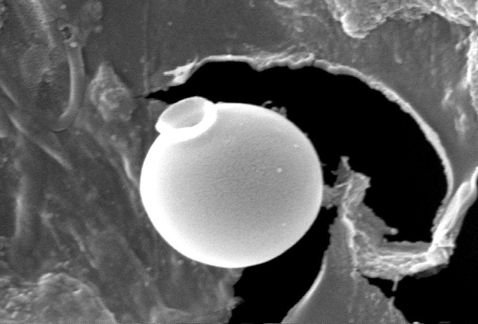 Microorganism round 